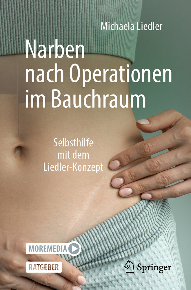 Narben nach Operationen im Bauchraum *