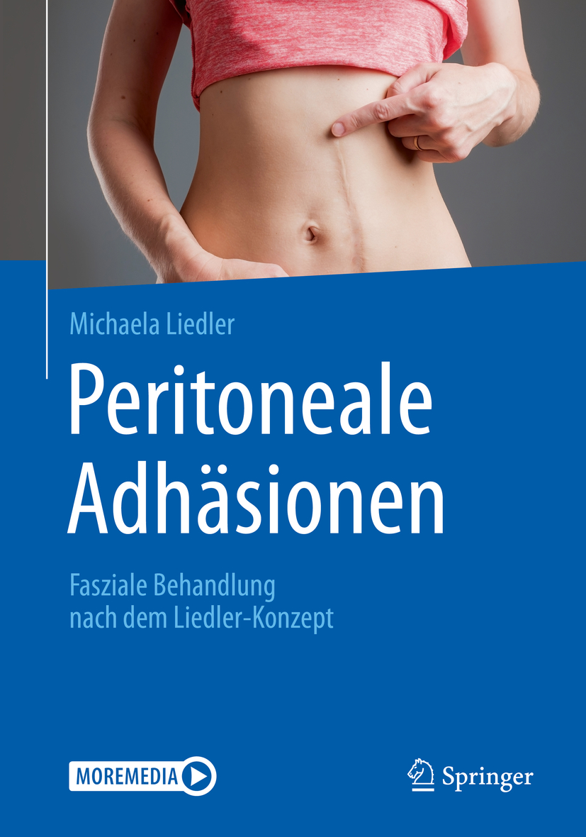 Peritoneale Adhäsionen *